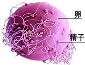 免疫性不孕癥如何治療?