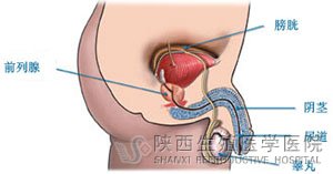 急性前列腺炎怎么治療好?